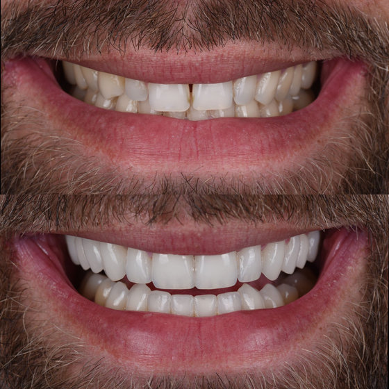Smile transformation 7
