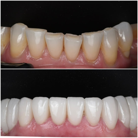 Smile transformation 9