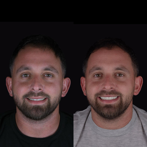 Smile transformation 12