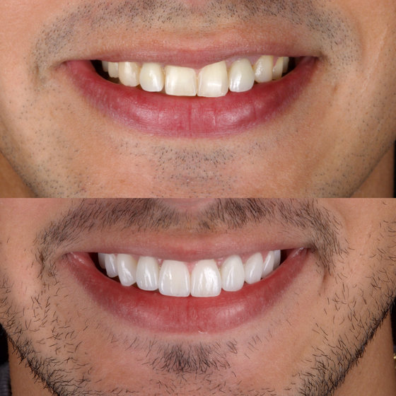 Smile transformation 19