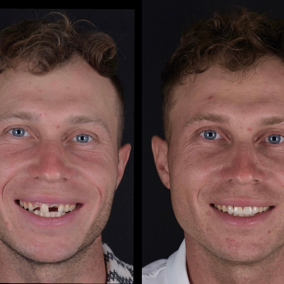 Smile transformation 20
