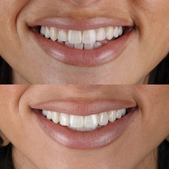 Smile transformation 7