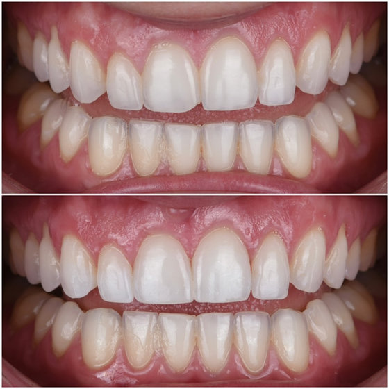 Smile transformation 8