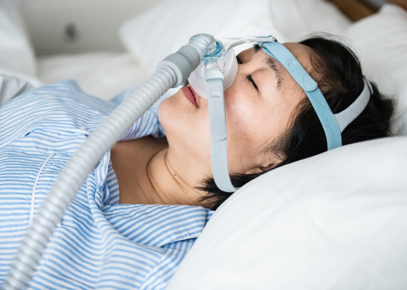 Custom oral appliance therapy