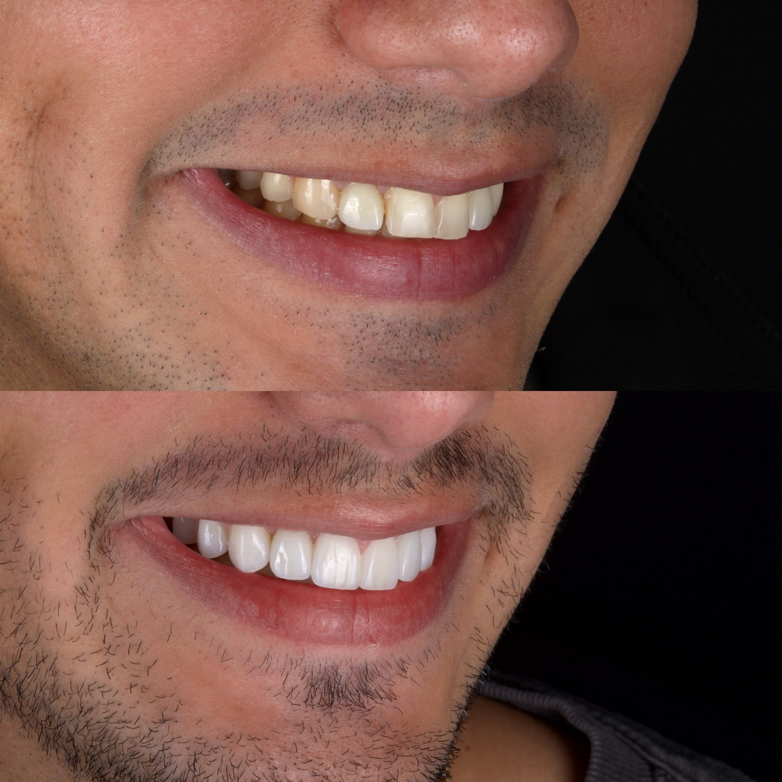 Cosmetic dentistry