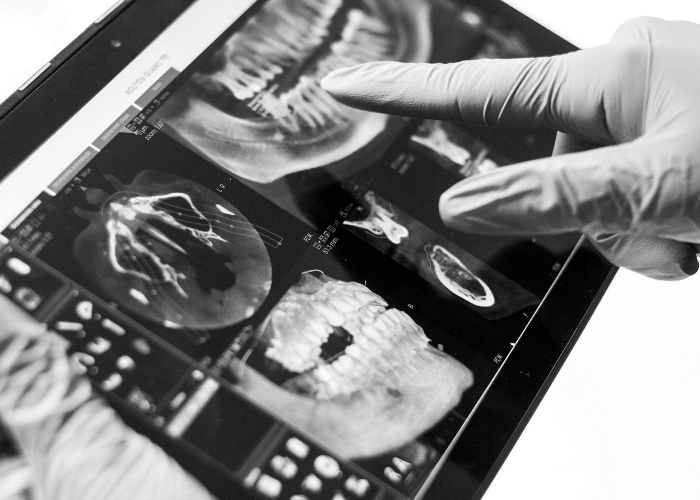 Digital dental imaging